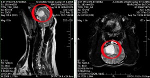 Butch MRI from OSU